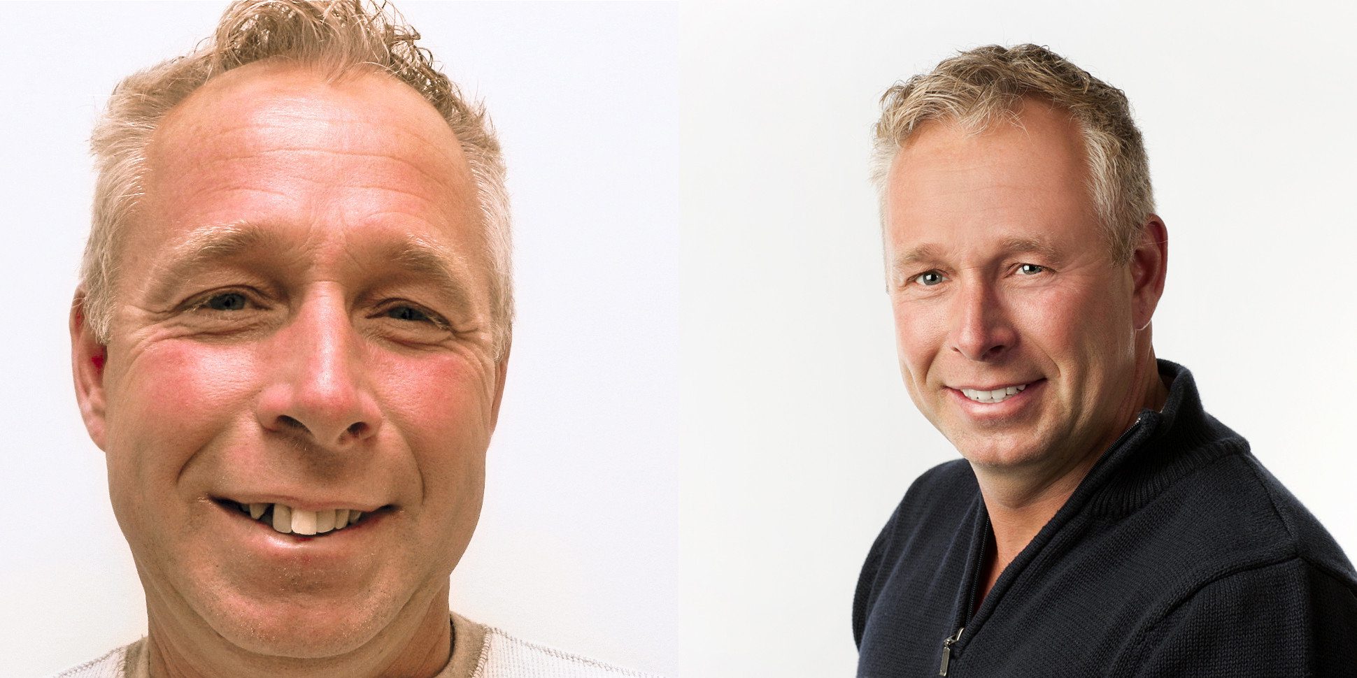 Antiaging dental Antiaging dental