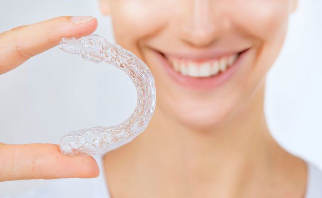 como funciona la ortodoncia invisible