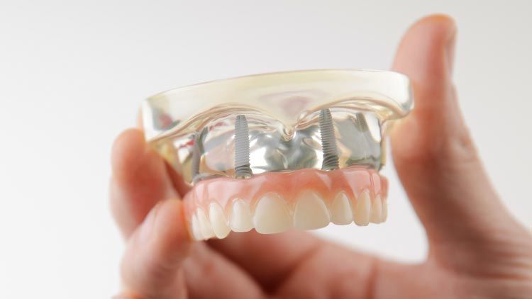 All on 4, Oliver Coll