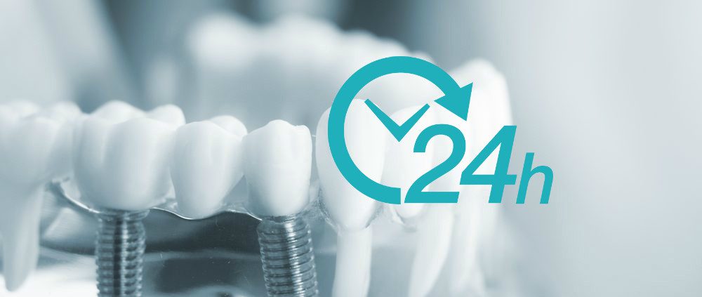Implantes dentales en 24h