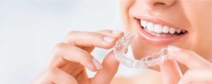 Invisalign, Clinica dental en Mataró