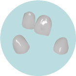 Carillas dentales en Oliver Coll