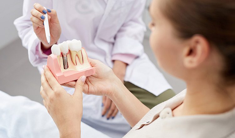 implante-dental-maqueta