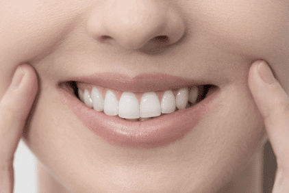 Dientes perfectos con el contorneado dental