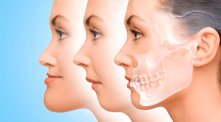 Cirugia_ortognatica