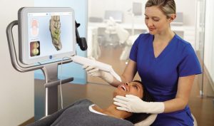 Escáner intraoral iTero