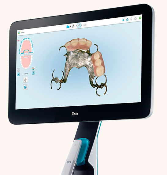 Escaner_intraoral_itero_2