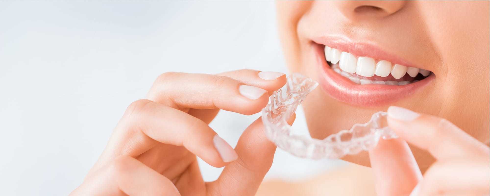 Invisalign, Clinica dental en Mataró