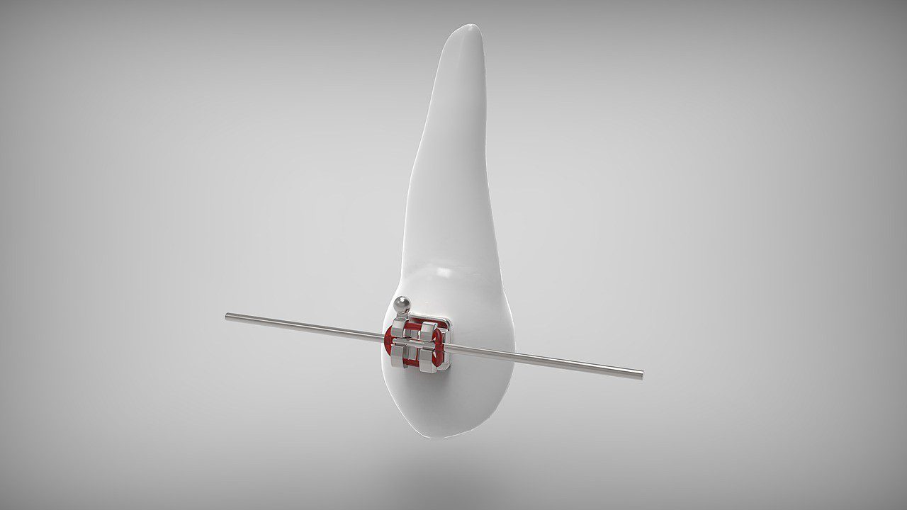 Ortodoncia, Oliver Coll