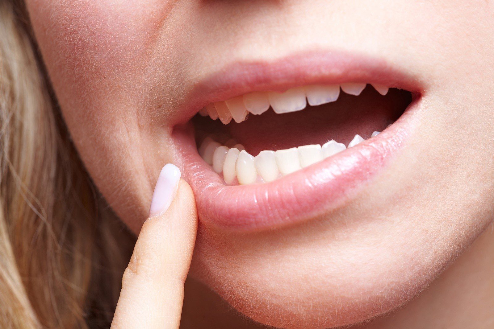 Periodontitis: tratamiento