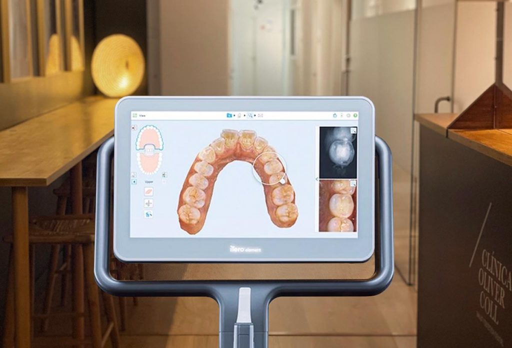 La última tecnología en tu clínica dental en Mataró