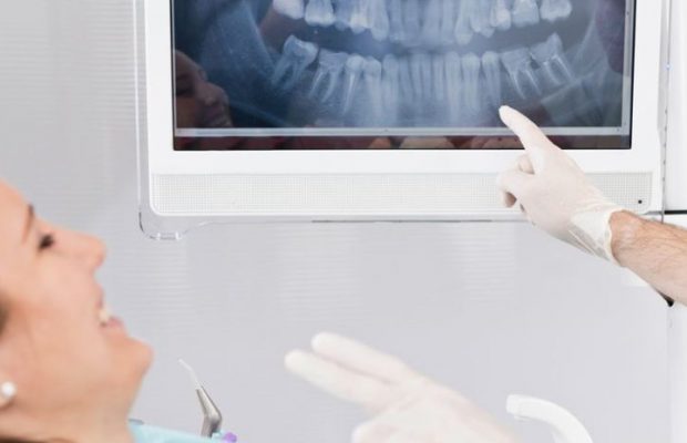 Cuando recurrir a implantes dentales, Oliver Coll