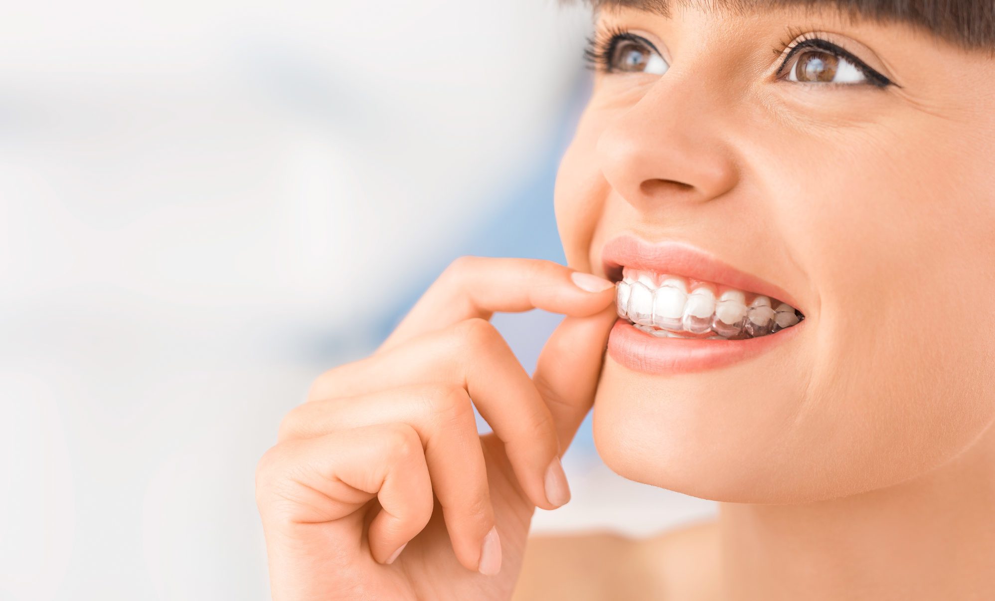 Ortodoncia invisible, ¿se nota?