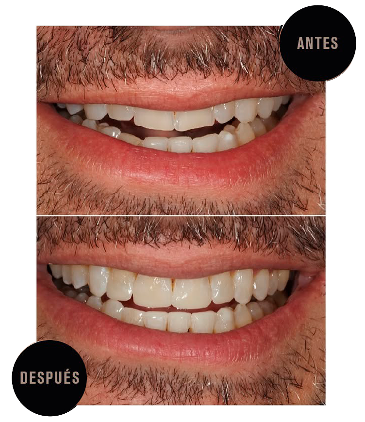 Reconst_composite