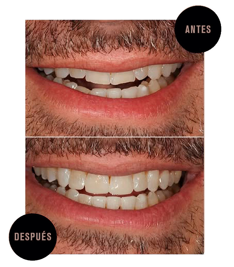 Reconstruccion_composite